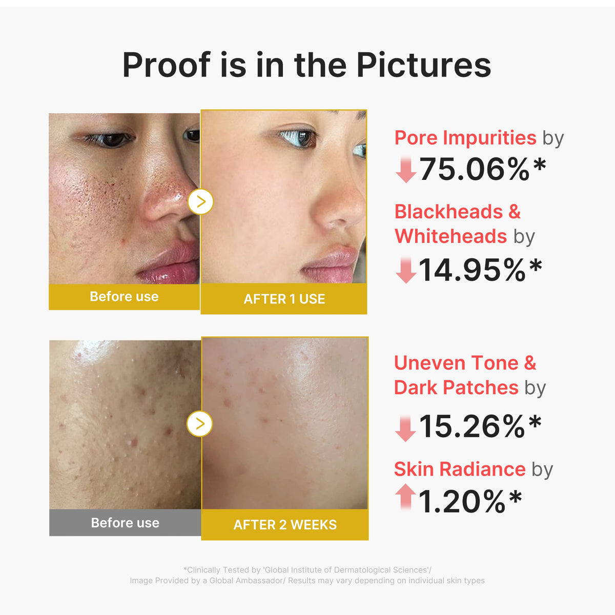 kojic-acid-turmeric-peel-shot-l4 02_45fe66d3-b3f6-4100-aa52-2afd7eded417.jpg