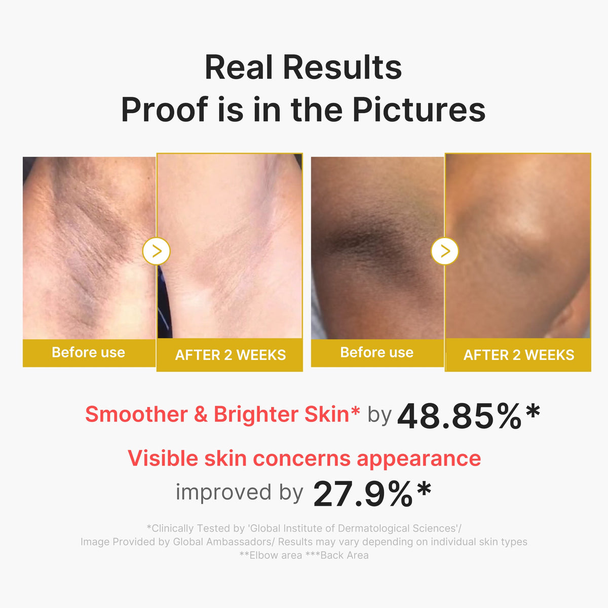 kojic-acid-turmeric-body-peel-shot-w8 02_72880cfc-382b-440b-8152-7e3dce87da2a.jpg