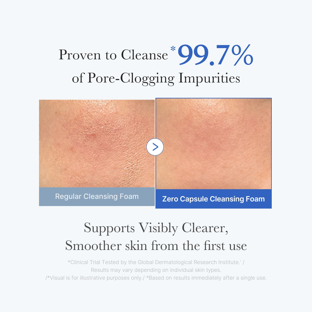 zero-pore-capsule-cleansing-foam-l1 02_c1fb9dfb-86c5-4038-8ff8-490d1006276c.jpg