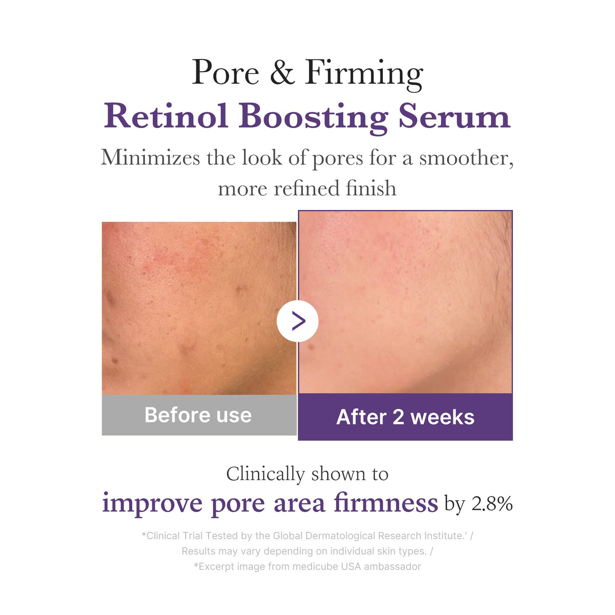 retinol-nmn-boosting-serum-y0 03_3510e7a5-5633-4a18-81ea-1389593bd517.jpg