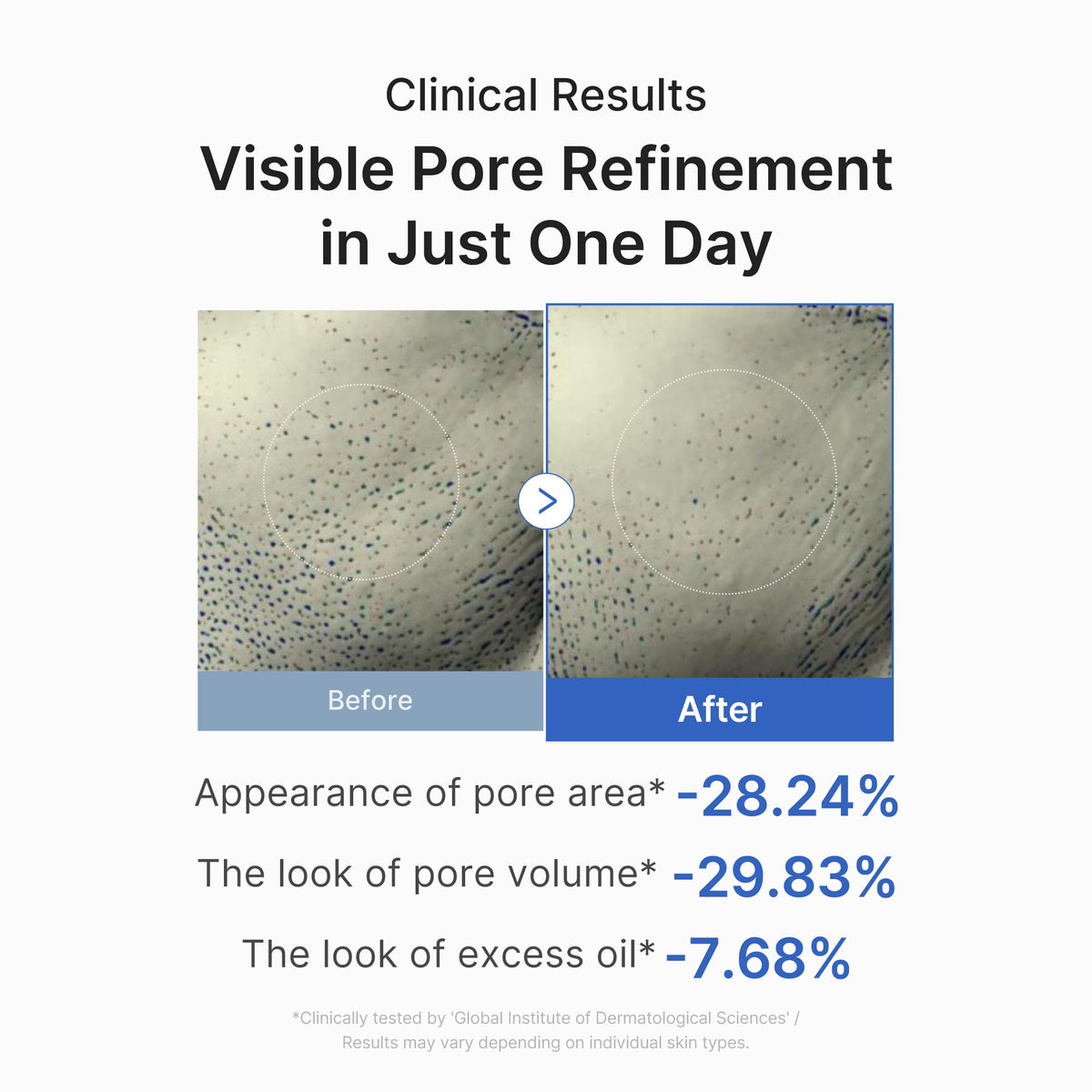 zero-pore-one-day-peptide-serum-d3 03_448eab9e-dc60-4dcb-9e4e-e863aabb61b0.jpg
