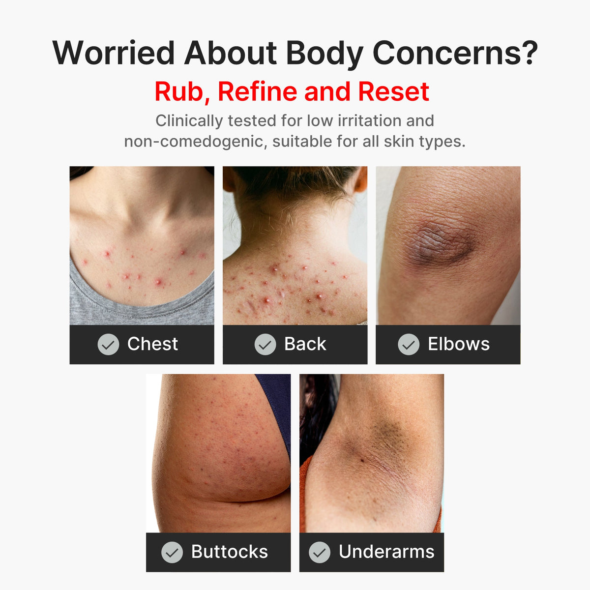 kojic-acid-turmeric-body-peel-shot-w8 04_8a7237f2-3ebf-401e-bd85-54841aeb3efc.jpg