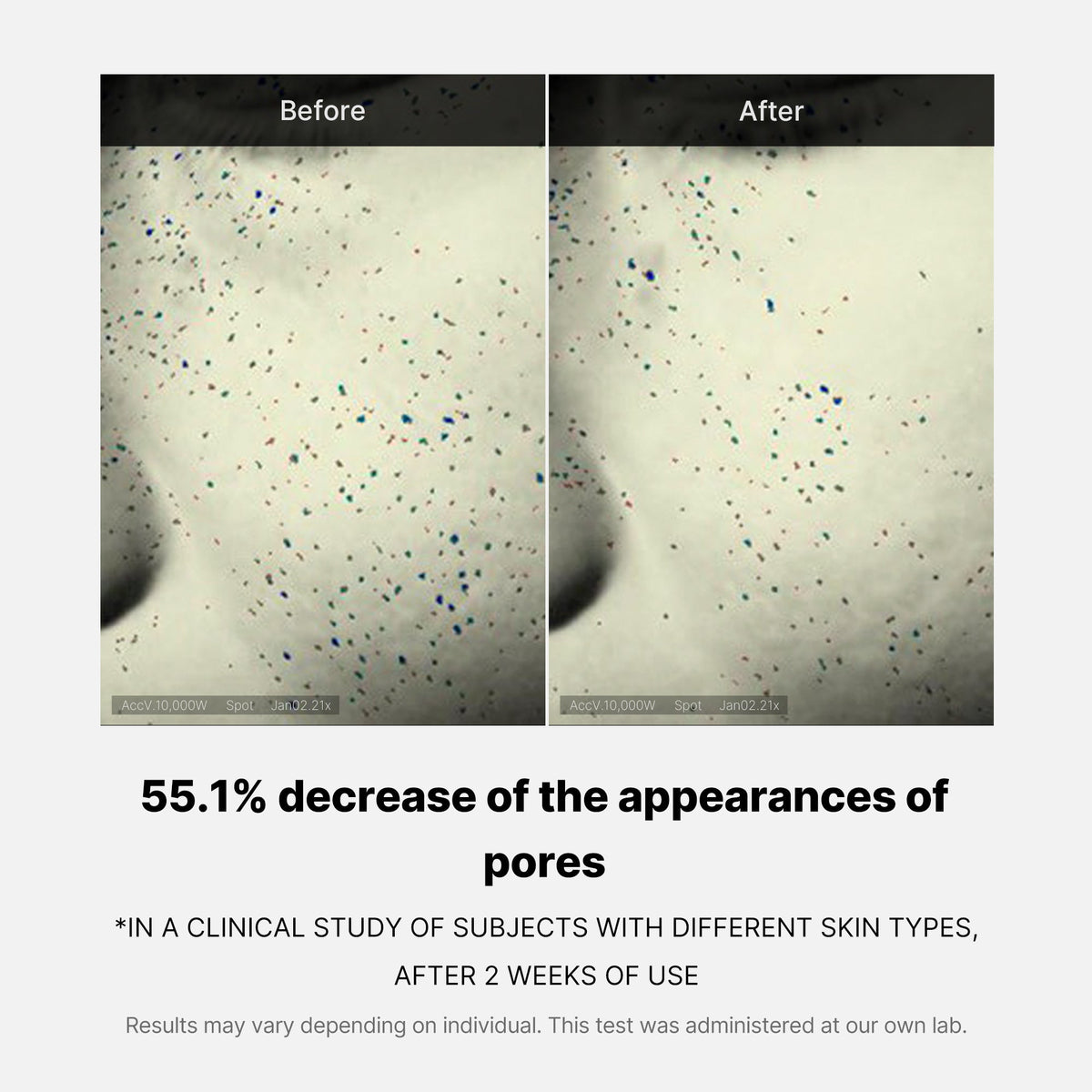 pore-care-duo-g1 05_12ddab8a-64be-4612-8ee1-27e5ec701921.jpg