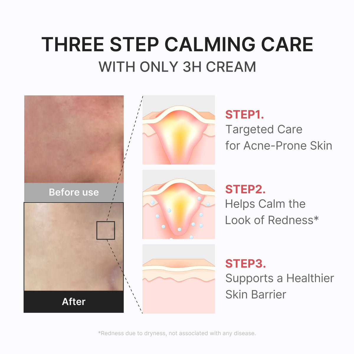 3h-daily-relief-cream-p8 3H_04.jpg