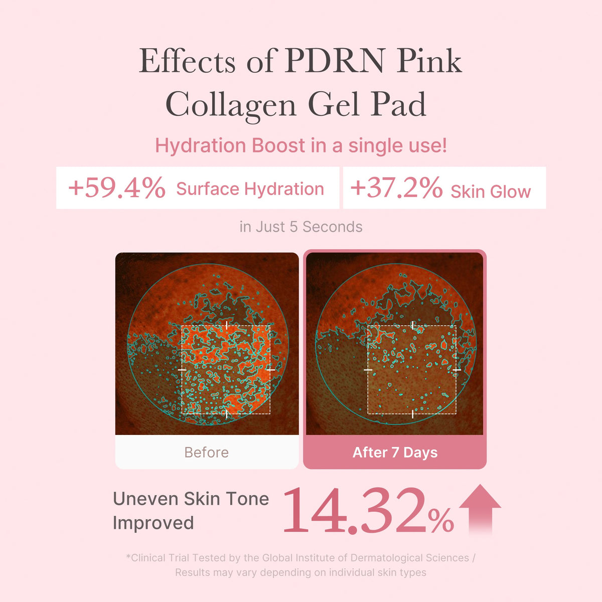 pdrn-pink-collagen-gel-toner-pad-d7 PDRN_04_f9a16a56-8d9e-4c47-a635-ed34ec3ed571.jpg